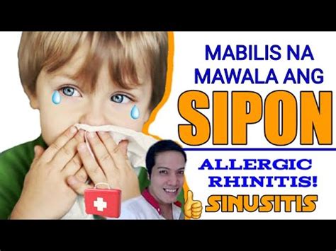 mabisang gamot sa allergic rhinitis|Allergic Rhinitis .